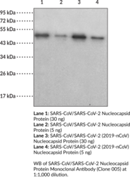 SARS-CoV/SARS-CoV-2 Nucleocapsid Protein Monoclonal Antibody (Clone 005)