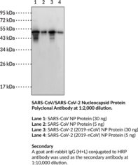 SARS-CoV/SARS-<wbr/>CoV-2 Nucleocapsid Protein Polyclonal Antibody