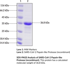 SARS-CoV-2 Papain-like Protease