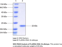 Fc?RIIIb/<wbr/>CD16b HNA-1b allotype (human, recombinant)