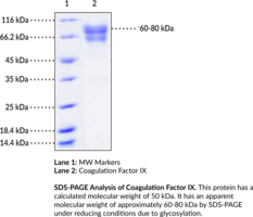 Coagulation Factor IX (human, recombinant)