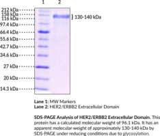 HER2/ERBB2 Extracellular Domain (human, recombinant)