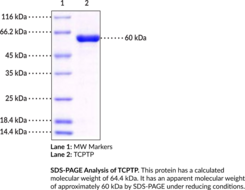 TCPTP (human, recombinant; aa 1-314)