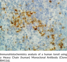 γ Heavy Chain (human) Monoclonal Antibody