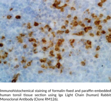 Ig? Light Chain (human) Rabbit Monoclonal Antibody