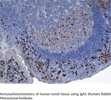 IgA1 (human) Rabbit Monoclonal Antibody