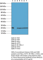 Histone H2A (C-Term) Monoclonal Antibody