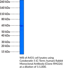 Cytokeratin 5 (C-Term; human) Rabbit Monoclonal Antibody