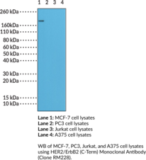 HER2/ErbB2 (C-Term) Monoclonal Antibody