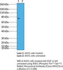 RSK1 (Phospho-Thr<sup>359</sup>/Ser<sup>363</sup>) Rabbit Monoclonal Antibody