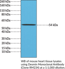 Desmin Monoclonal Antibody