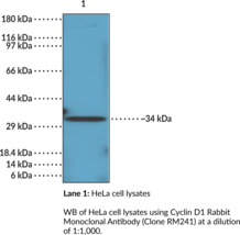 Cyclin D1 Rabbit Monoclonal Antibody