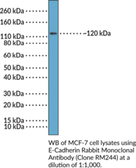 E-Cadherin Rabbit Monoclonal Antibody