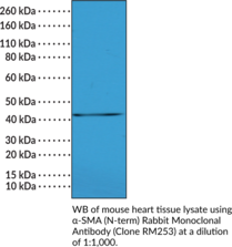 α-SMA (N-Term) Rabbit Monoclonal Antibody