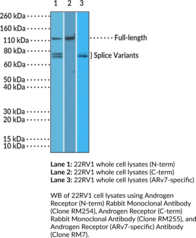 Androgen Receptor (N-Term) Rabbit Monoclonal Antibody