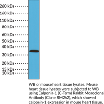 Calponin-1 (C-Term) Rabbit Monoclonal Antibody