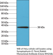 Synaptophysin (C-Term) Rabbit Monoclonal Antibody