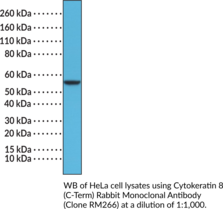 Cytokeratin 8 (C-Term) Rabbit Monoclonal Antibody