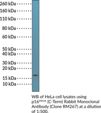 p16<sup>INK4A</sup> (C-Term) Rabbit Monoclonal Antibody