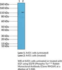 EGFR (Phospho-Tyr<sup>1173</sup>) Rabbit Monoclonal Antibody