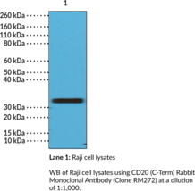 CD20 (C-Term) Rabbit Monoclonal Antibody