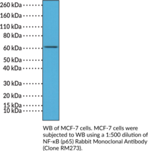 NF-?B (p65) Rabbit Monoclonal Antibody (Clone RM273)