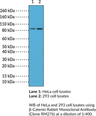 β-Catenin Rabbit Monoclonal Antibody