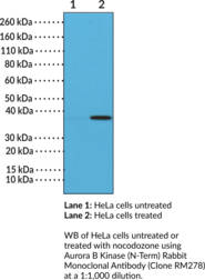 Aurora B Kinase (N-Term) Rabbit Monoclonal Antibody