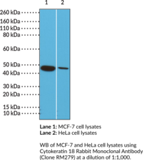 Cytokeratin 18 Rabbit Monoclonal Antibody