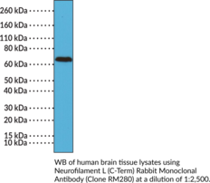 Neurofilament L (C-Term) Rabbit Monoclonal Antibody