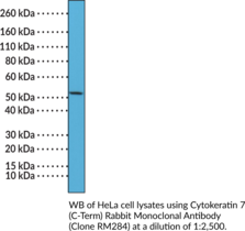 Cytokeratin 7 (C-Term) Rabbit Monoclonal Antibody