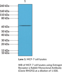 Estrogen Receptor ? Rabbit Monoclonal Antibody