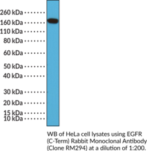 EGFR (C-Term) Rabbit Monoclonal Antibody