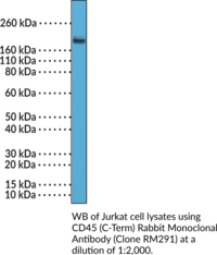 CD45 (C-Term) Rabbit Monoclonal Antibody (Clone RM291)