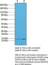 MAP1LC3B/LC3B (N-Term) Rabbit Monoclonal Antibody