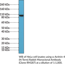 α-Actinin-4 (N-Term) Rabbit Monoclonal Antibody