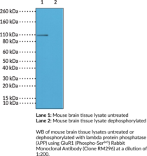 GluR1 (Phospho-Ser<sup>845</sup>) Rabbit Monoclonal Antibody