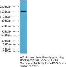 PDGFR?/CD140b (C-Term) Rabbit Monoclonal Antibody