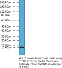 S100B (C-Term) Rabbit Monoclonal Antibody