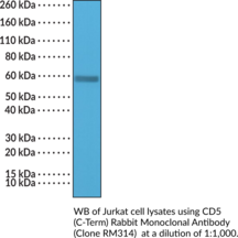 CD5 (C-Term) Rabbit Monoclonal Antibody