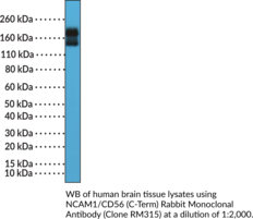 NCAM1/CD56 (C-Term) Rabbit Monoclonal Antibody