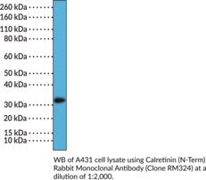 Calretinin (N-Term) Rabbit Monoclonal Antibody