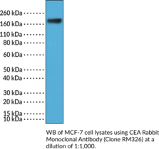 CEA Rabbit Monoclonal Antibody