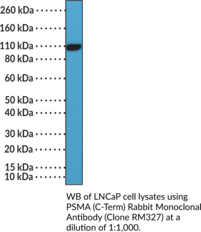 PSMA (C-Term) Rabbit Monoclonal Antibody