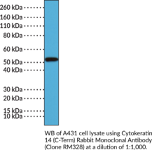 Cytokeratin 14 (C-Term) Rabbit Monoclonal Antibody