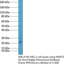 MART1 (N-Term) Rabbit Monoclonal Antibody