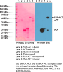 PSA Rabbit Monoclonal Antibody