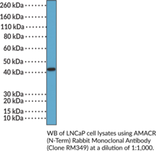 AMACR (N-Term) Rabbit Monoclonal Antibody