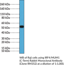 IRF4/MUM1 (C-Term) Rabbit Monoclonal Antibody