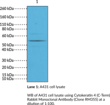 Cytokeratin 4 (C-Term) Rabbit Monoclonal Antibody